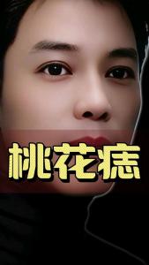 女人人中痣小心爛桃花