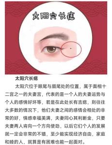 女人的痣長在太陽穴上命運如何
