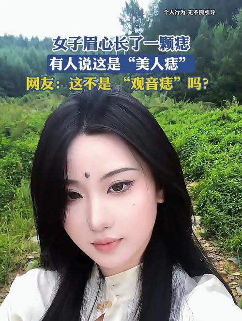 長妖痣的漂亮是真的嗎