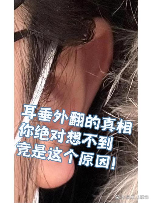 耳垂往上翹是什么命