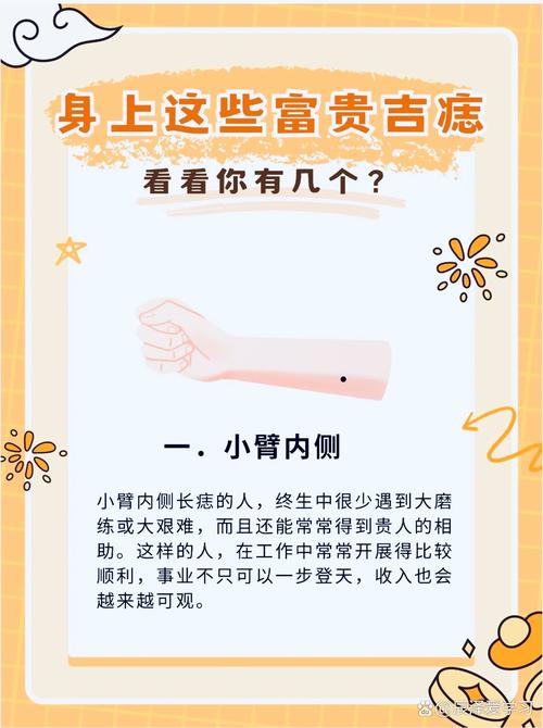 富貴招財?shù)娜N痣，你有嗎