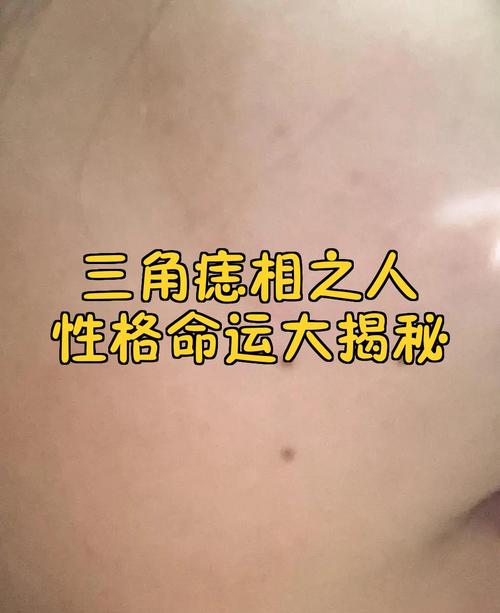 額頭有三顆痣成三角形