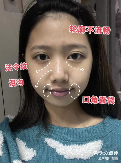 法令紋深的人報(bào)復(fù)心很強(qiáng)是真的嗎