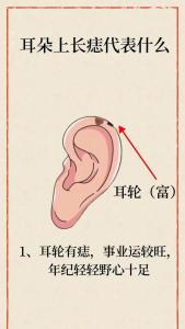 男人耳朵有痣代表什么