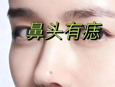 命里藏金的痣