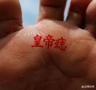 女有成闊太，男有成權貴的帝王痣