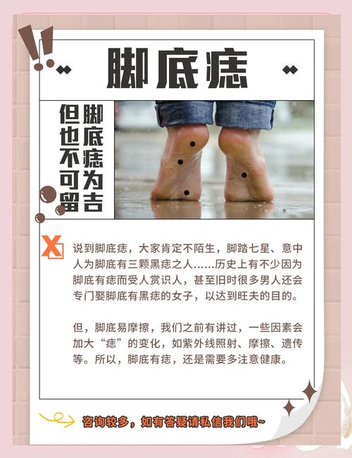 腳上有痣的人會有什么命