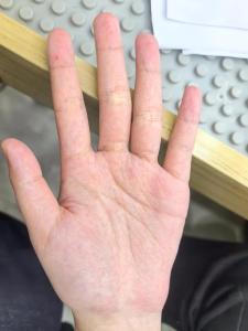手掌亂紋多預示著什么