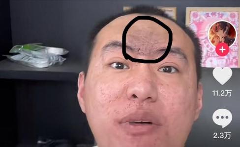 印堂發黑多災難嗎