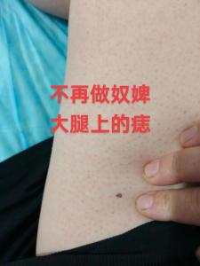 這幾種腿上的痣是大兇之相