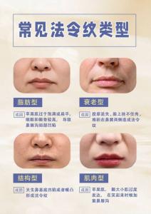 面相中法令紋好不好