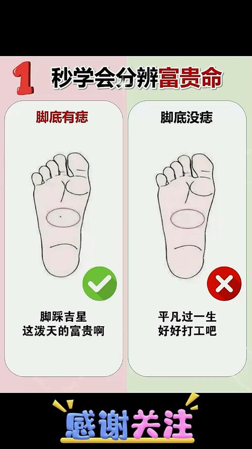 女人大腳趾長痣代表什么