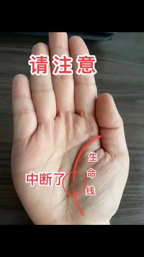 手相生命線斷開會早死嗎 生命線斷開且斷處雜紋眾多情緣欠佳