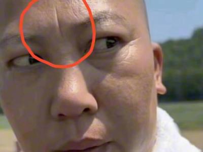 懸針紋財運(yùn)不好嗎 窮人的面相有哪些