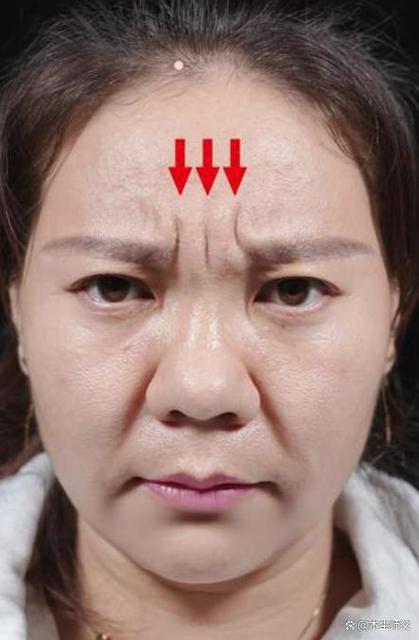 眉間帶有川字紋財運差嗎