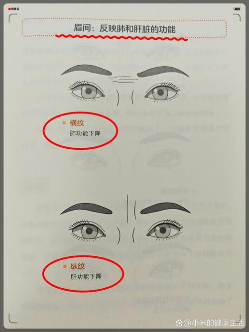 眉毛上方有皺紋圖解 眉毛上的皺紋好不好