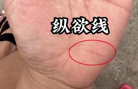 縱欲線預示著什么呢