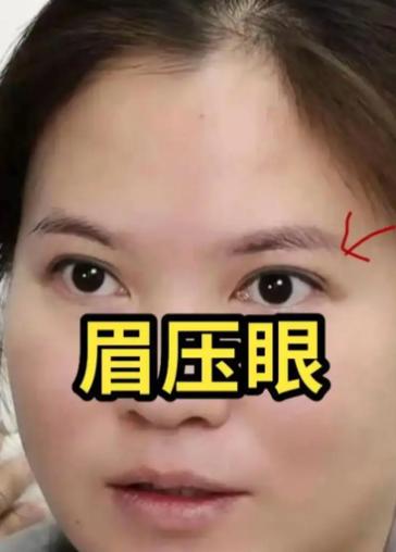 臉上有這些特征可能會破財