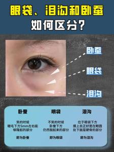 面相解讀：臥蠶眼為什么人們都喜歡
