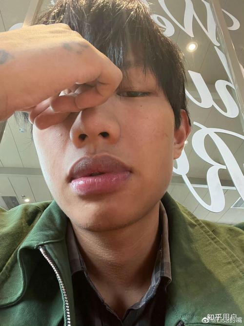 嘴唇厚的男人能嫁嗎