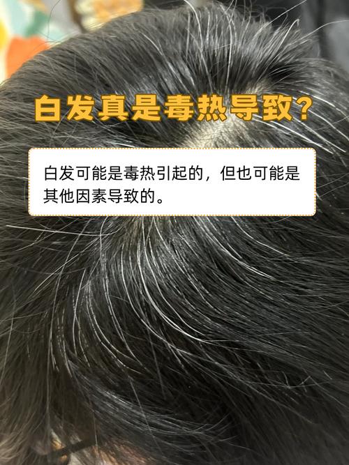 女性臉上長白毛命理推測