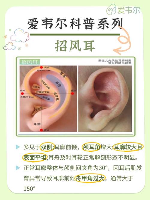 招風耳如何形成的？都是遺傳的嗎