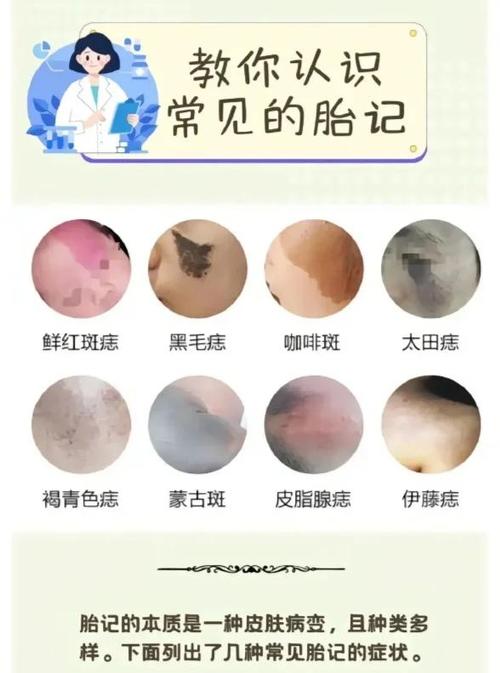 女人胎記長哪里比較好？背部正中的胎記有什么意義