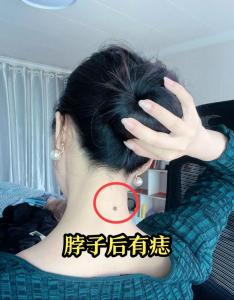 代表財運出色的痣相 珍惜脖子上有三顆痣