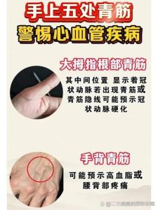 青筋與命運的關系