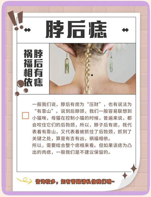 脖子上有痣代表什么  在正中央預示飛黃騰達