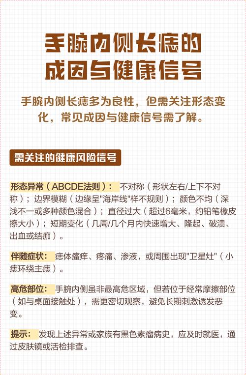 男人手腕有痣代表什么