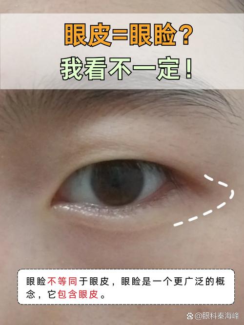 三層眼皮是屬于什么眼