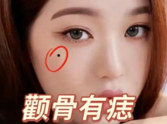 顴骨有痣好不好？有可能會被人橫刀奪愛