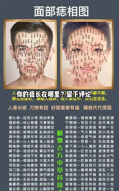 面部長“是非痣”代表易與人產生口舌之爭？