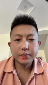 男人下巴有痣長毛好嗎？有福氣，家運不錯！