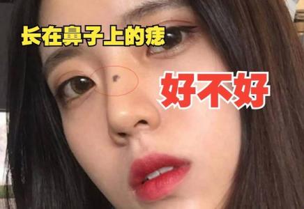 女人鼻梁上有痣，往往夫運不佳？