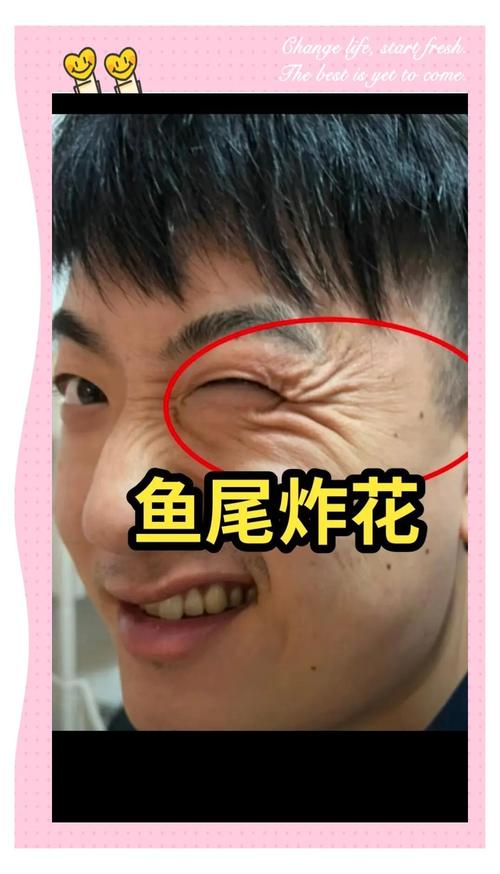 天生魚尾紋的命運 男人魚尾紋預示著什么