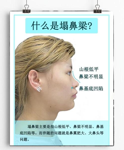 女人鼻子塌代表什么