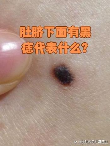 肚臍下方有痣的男人，感情生活豐富難安定？