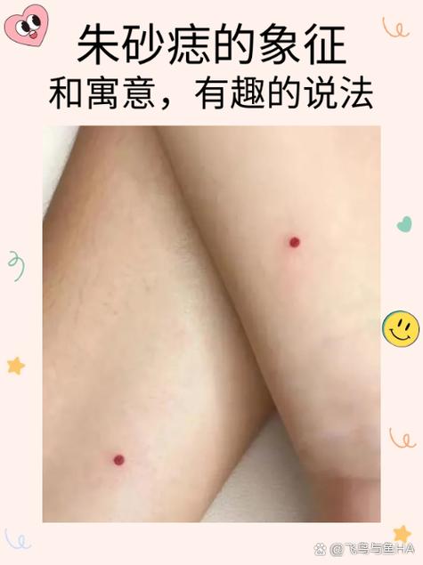 男生點(diǎn)朱砂痣是什么意思 點(diǎn)朱砂痣祈求平安