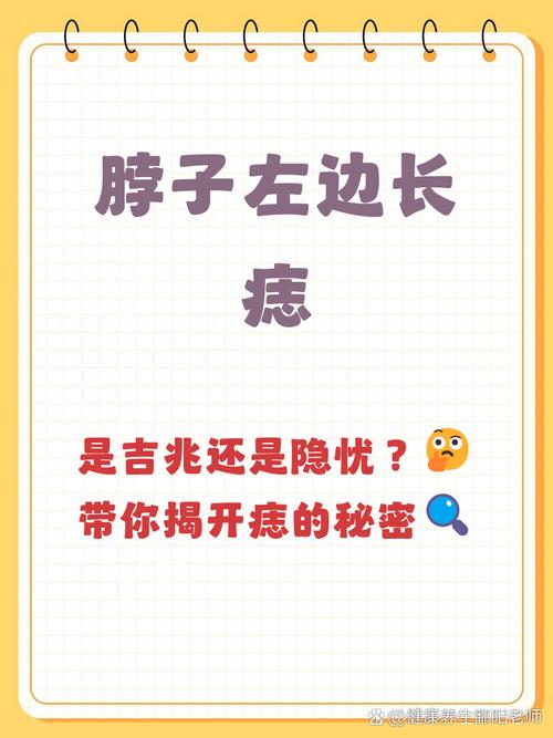 脖子左側有痣的男人 脖子左側有痣的命運如何分析