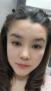 窮賤一生的女人面相 額頭中間有疤事業(yè)不順