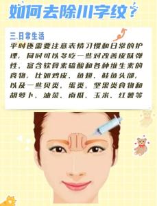 女人臉上川字紋怎么回事