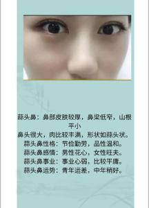 面相解析:蒜頭鼻的人面相是什么樣的，蒜頭鼻的人面相好不好