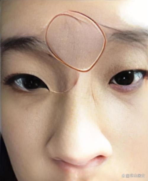 女人印堂發黑,女人印堂發黑是什么