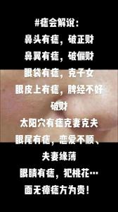 山根痣的準確位置圖,山根有痣代表什么意思?