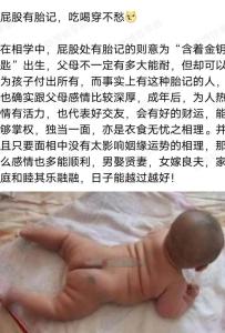 屁股有胎記是神仙轉世,寶寶出生為什么有胎記