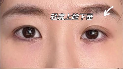 眼角下垂的女人面相 脾氣溫和