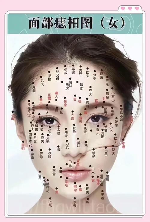 臉上哪些是痣是福氣不能點