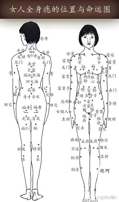 肩膀痣代表什么圖解